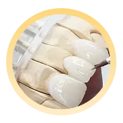 Bước 3