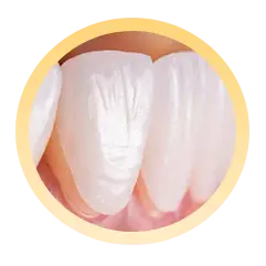 Bước 4