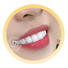 Bước 5