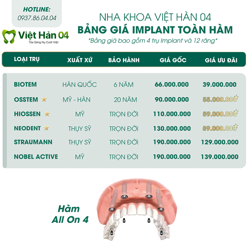 Bảng giá trồng răng toàn hàm All On 4 - Nha Khoa Việt Hàn 04