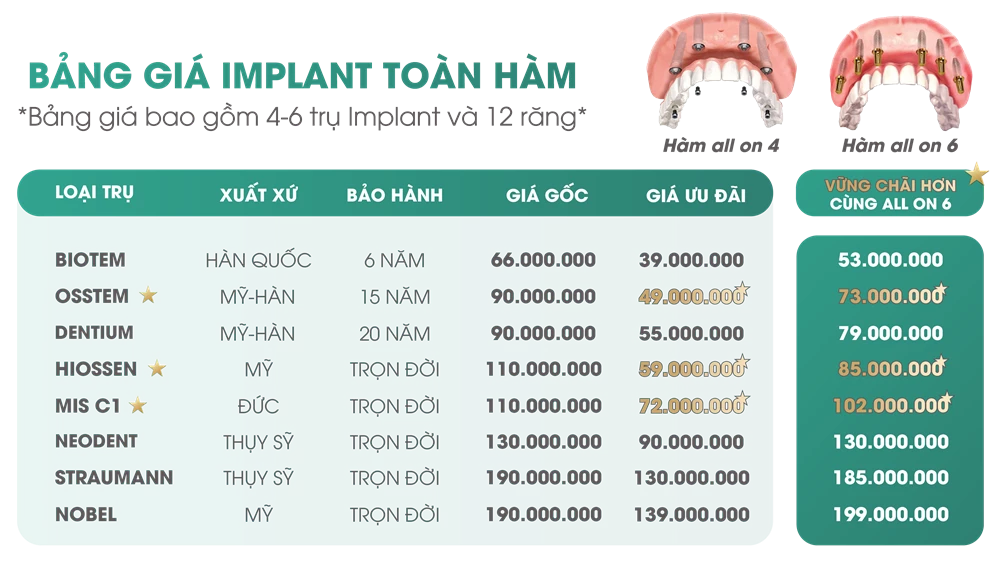 Bảng giá Implant toàn hàm All On 4 - All On 6