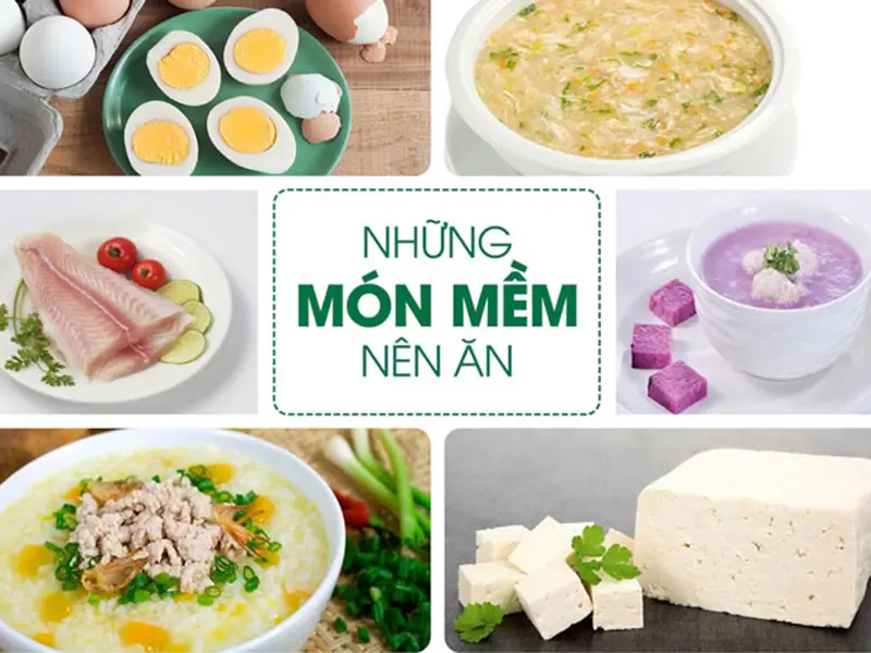 Các món ăn nên ăn sau trồng răng Implant