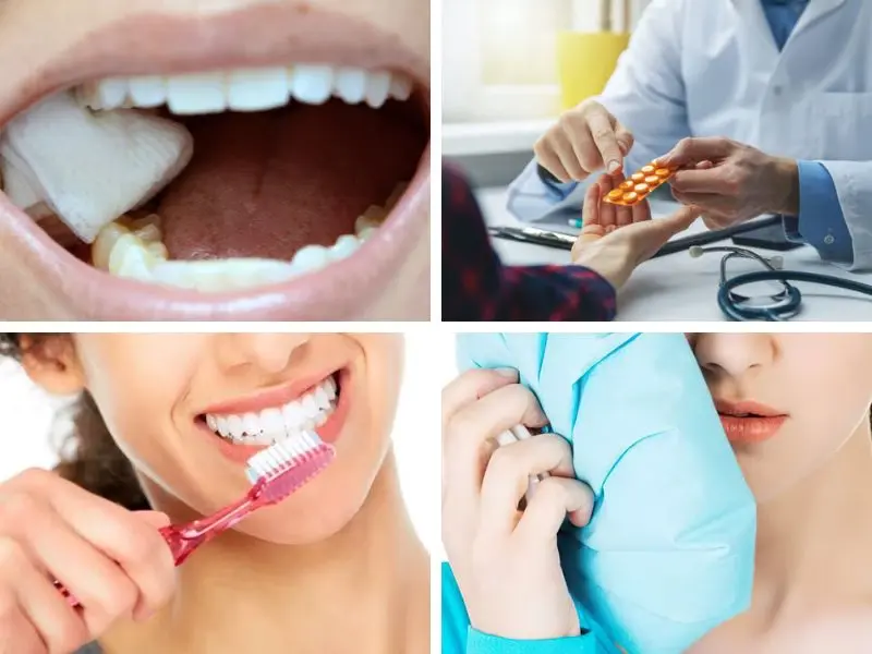 Chăm sóc răng miệng sau khi cấy ghép implant 
