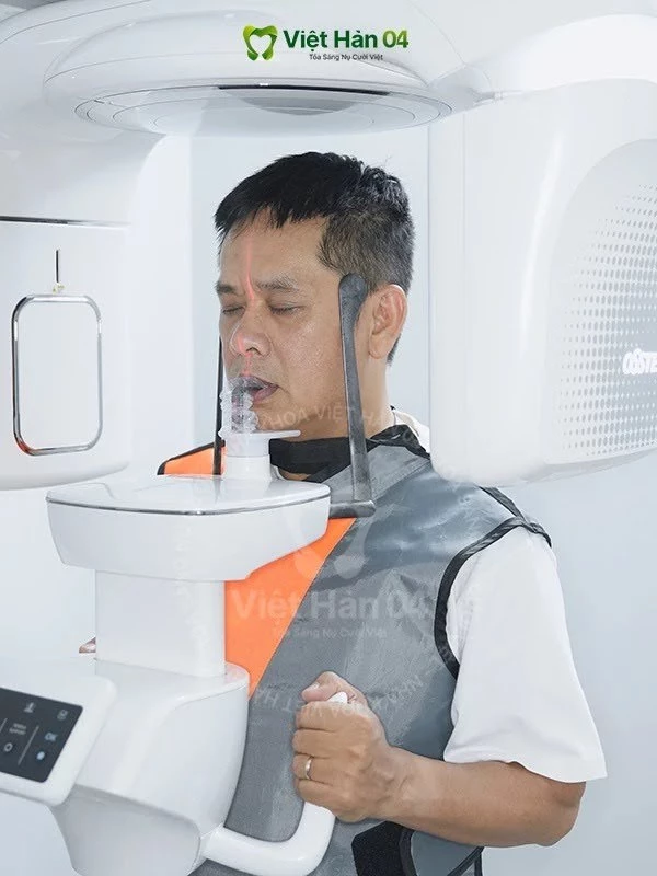Chụp phim CT Cone Beam và lấy dấu hàm hiện đại