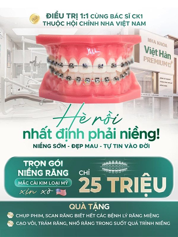Ưu đãi niềng răng thẩm mỹ