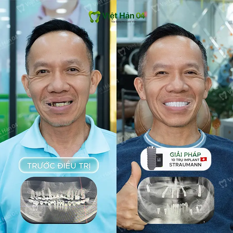 KH Trung Đinh - Việt kiều Mỹ