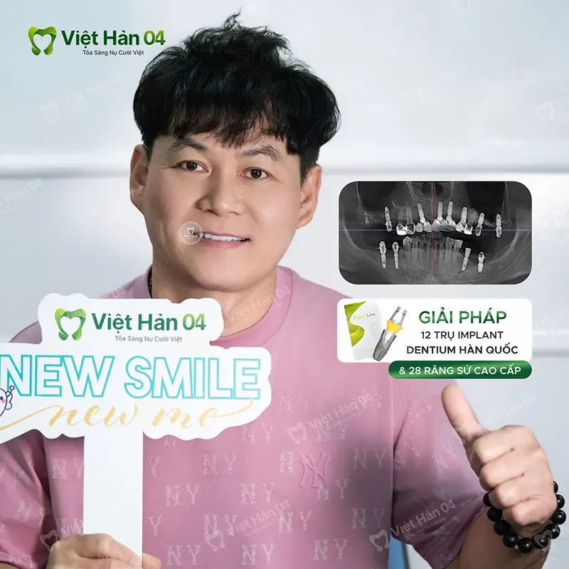 Khách hàng cắm 12 trụ Implant Dentium Hàn Quốc & thẩm mỹ 28 răng sứ cao cấp
