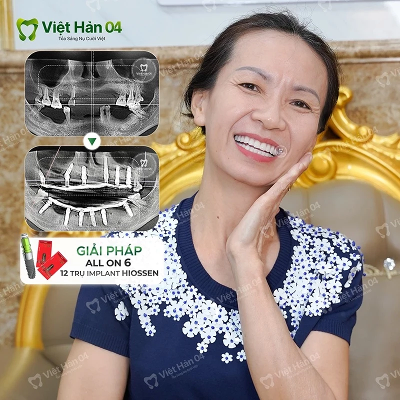 Khách hàng Kim Liên - TPHCM