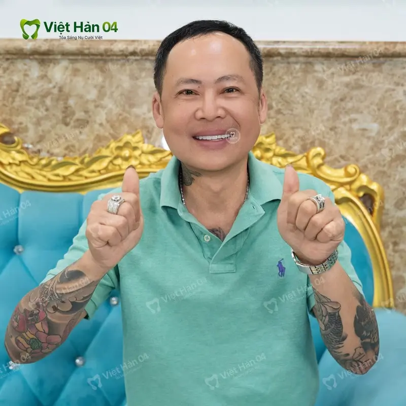 Khách hàng Quốc Bảo cấy ghép Implant nguyên hàm