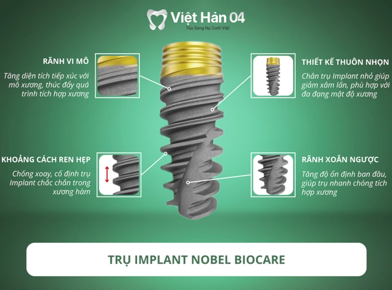 Implant Nobel Biocare (Mỹ) được thiết kế thuôn nhọn, rãnh xoắn ngược và khoảng cách ren hẹp