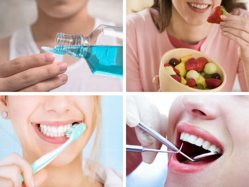 Những lưu ý quan trọng sau cấy ghép implant để bảo vệ trụ lâu dài 