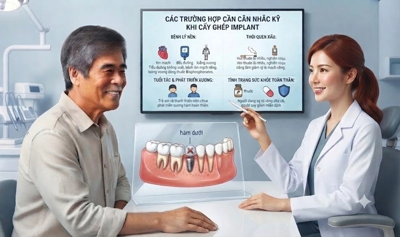 Cấy ghép implant không phù hợp với mọi đối tượng