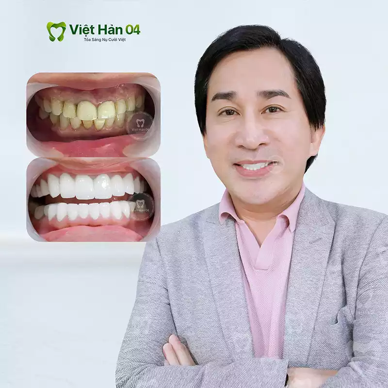NSUT Kim Tử Long - Nha Khoa Việt Hàn 04