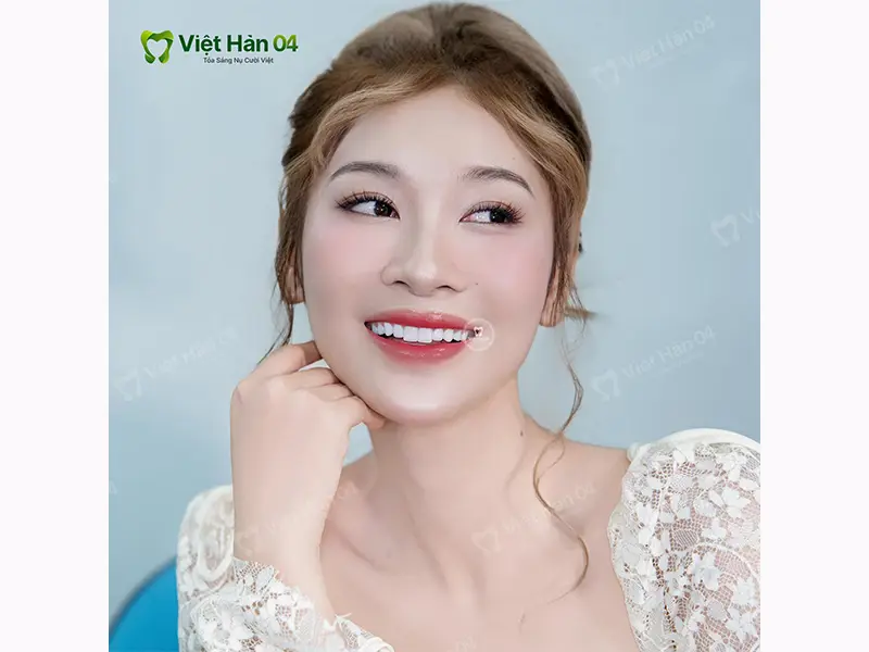 Thẩm mỹ răng sứ là gì?