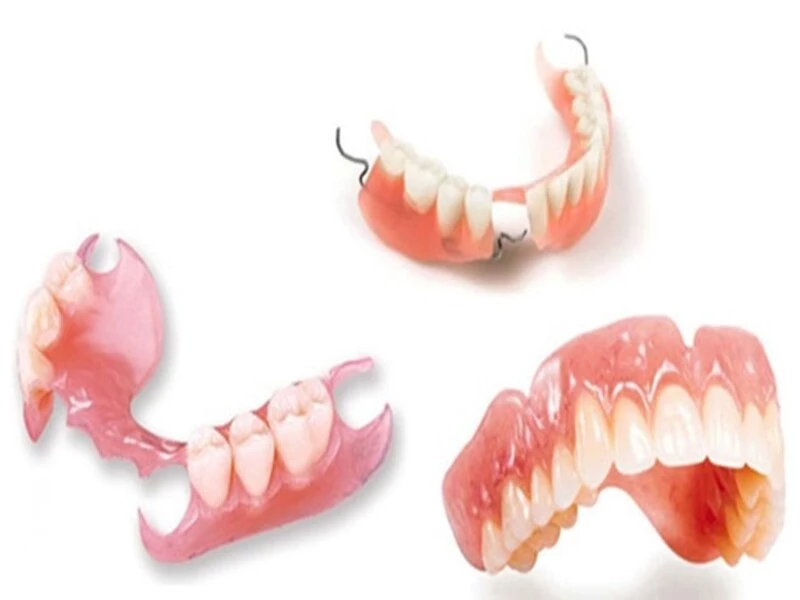 Hàm giả tháo lắp nguyên hàm bằng nền nhựa truyền thống 