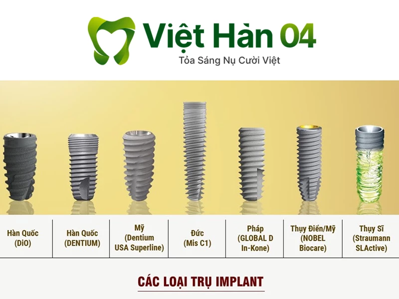 Trụ Implant
