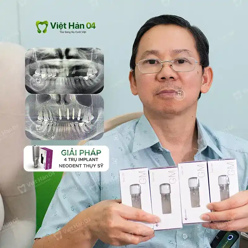 Khách hàng Khánh Phong - Việt Kiều Mỹ - Cấy ghép Implant Thụy Sĩ - Nha Khoa Việt Hàn 04