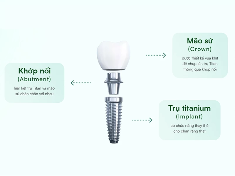 Hình ảnh cấu tạo trụ Implant
