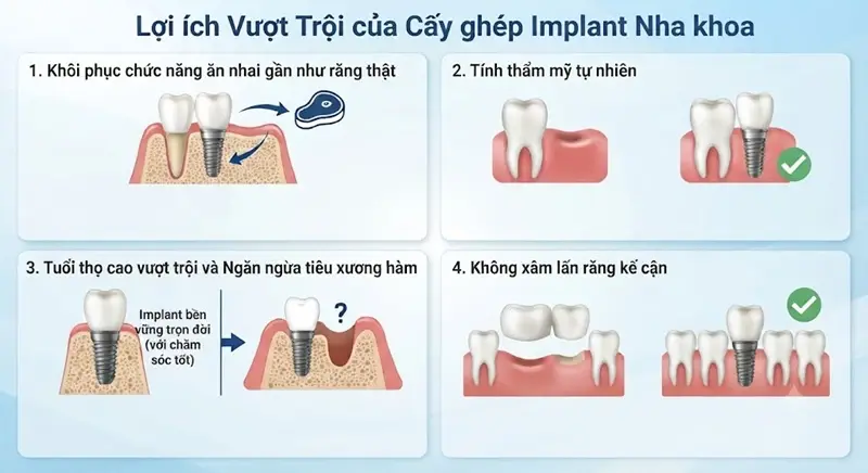 Trồng răng Implant sở hữu những ưu điểm vượt trội 