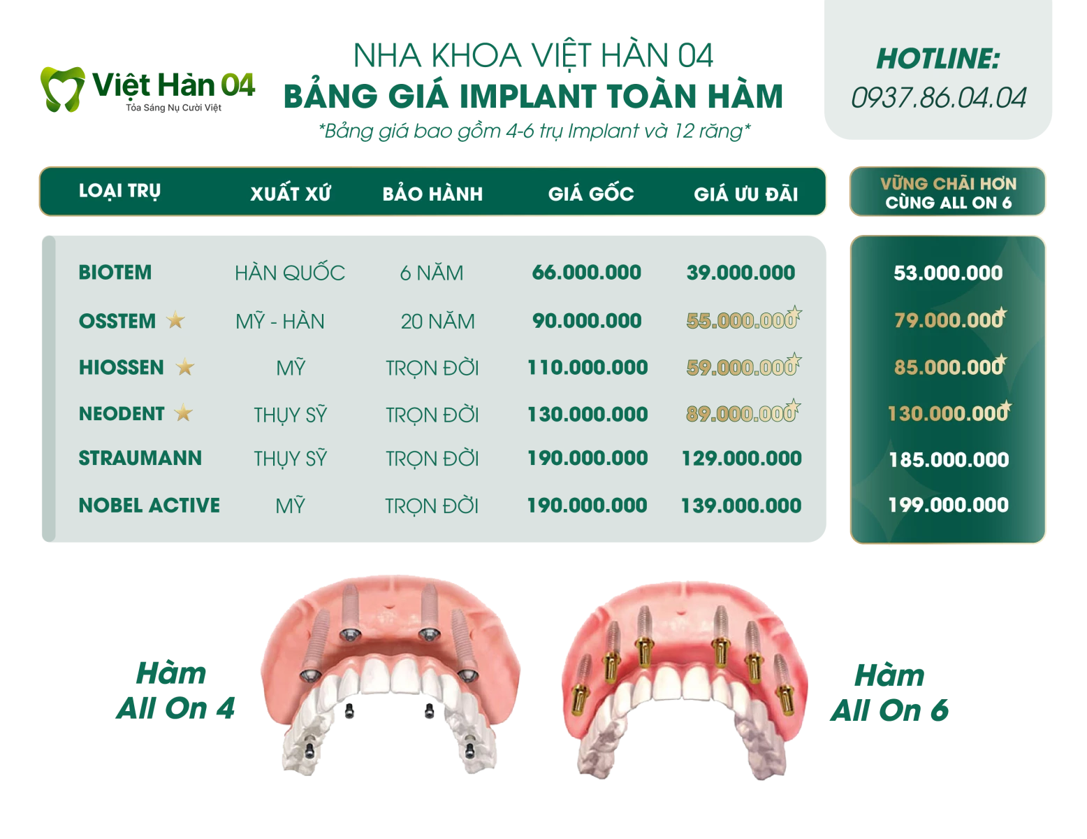 Bảng giá về cấy ghép Implant nguyên hàm 