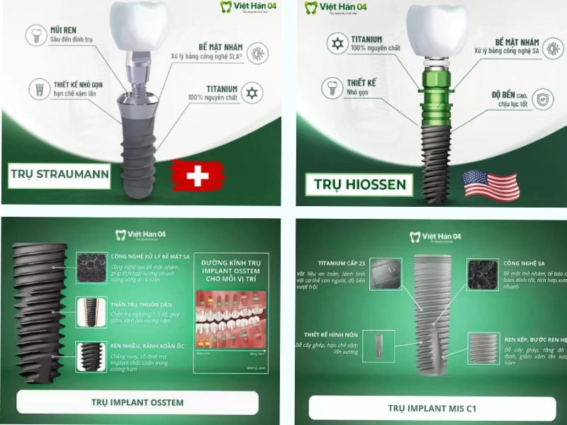 Sử dụng trụ implant chính hãng đảm bảo hiệu quả bền lâu và tăng tương thích sinh học 