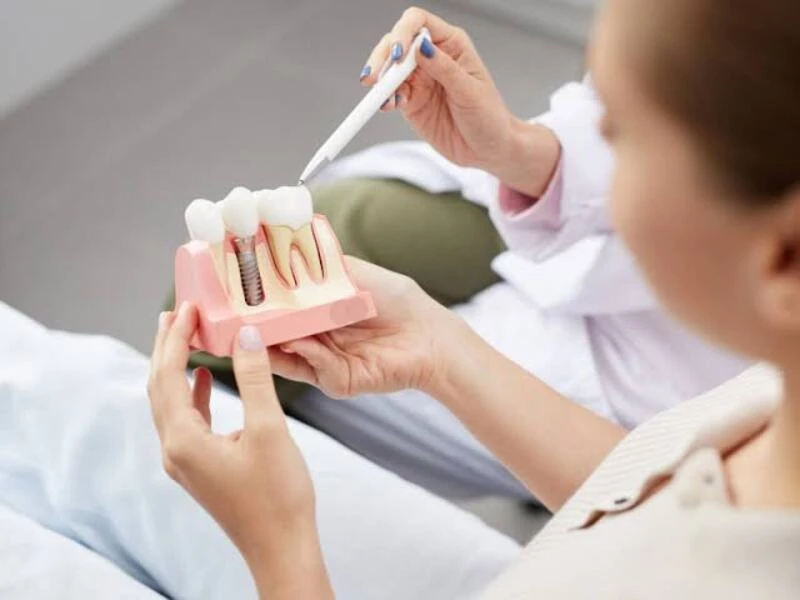 Tuân thủ hướng dẫn của bác sĩ giúp Implant nhanh lành và bền lâu 