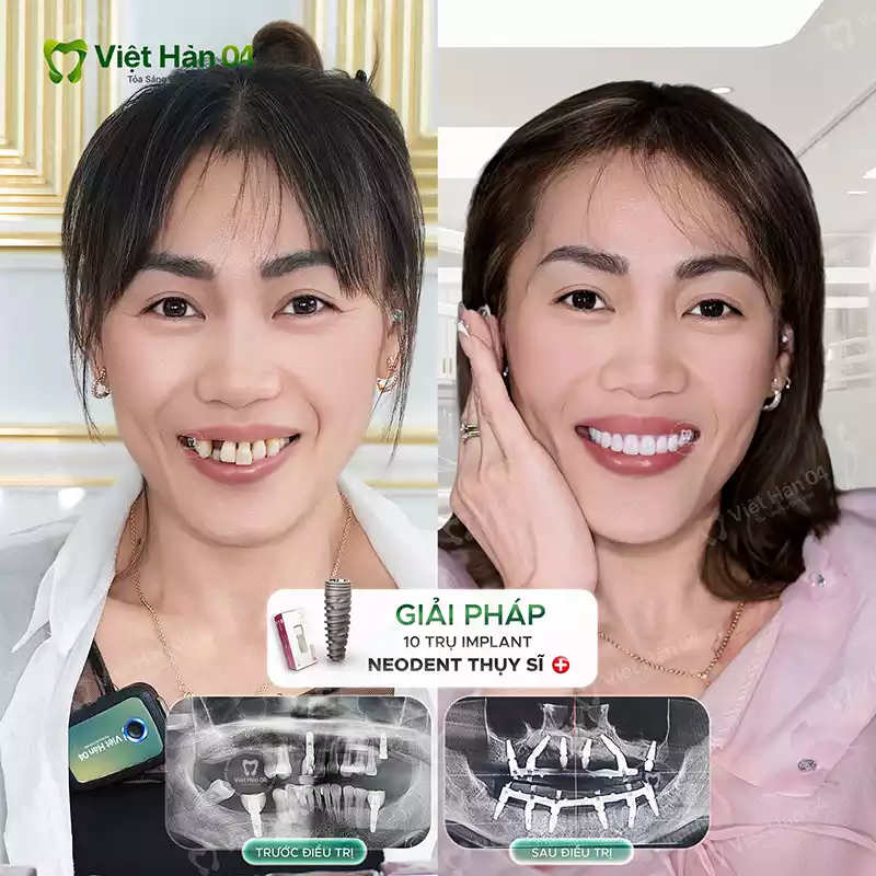 Khách hàng Trọng Nghĩa